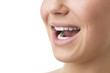 © Wolfgang Zwanzger - open mouth of woman