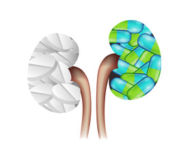 Sticker - Pills in the kidney shape. Kidney treatment concept.