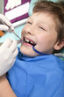 © Katarzyna Leszczynsk - Young boy in a dental surgery