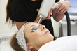 © highwaystarz - Beautician Carrying Out Fractional Laser Treatment