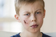 Young boy with face injury