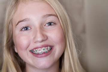 teen girl with braces on her teeth