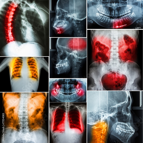 Naklejka - mata magnetyczna na lodówkę Collage of human X-rays photo