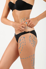 Sticker - Plastic surgery. Liposuction. Slim body concept