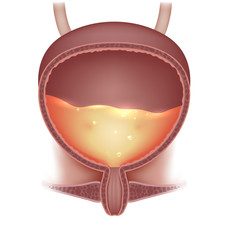 Poster - Urinary bladder with urine