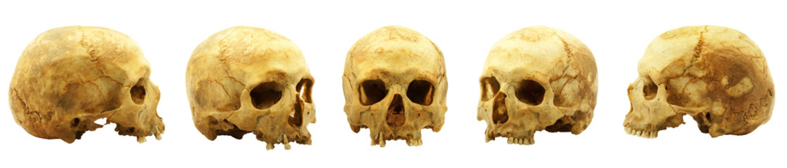 genuine human skull isolated on white, lipids makes skull yellow