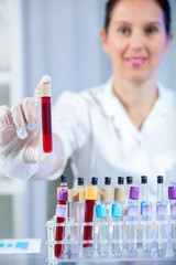 Test tube with blood sample in doctor hand