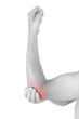 © Eskymaks - Elbow pain.
