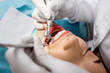 © rh2010 - Professional teeth cleaning