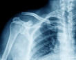 © oceandigital - x-ray chest