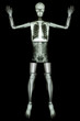 © stockdevil - Give Up EBOLA. (Human bone raise the hand) (Whole body)