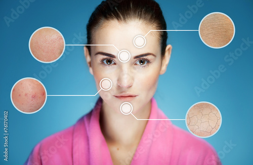 Fotografia, Obraz  Concept of skincare and skin problems of face