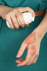 Wall Mural - Treatment of burns by spray on female hand, closeup