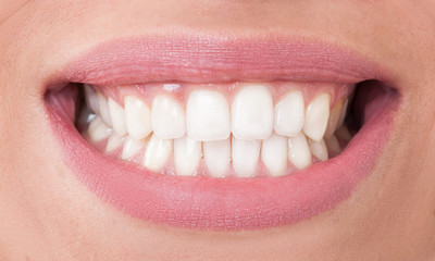 closeup with perfect female teeth