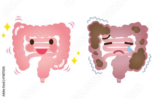 Valokuva  健康な大腸　便秘の大腸