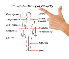 Wall Mural - Complications of Obesity