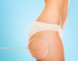 © Syda Productions - close up of woman buttocks with cellulite