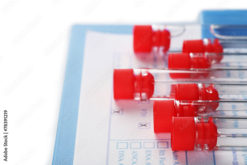 Test tubes and clipboard with medical history form close up