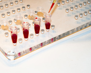 In medical laboratories studied blood.