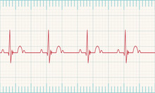 Heartbeat Rate