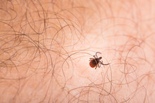 Tick - Parasitic Arachnid Blood-sucking Carrier