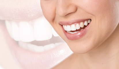 Teeth treatment, whitening and protection. Perfect white smile