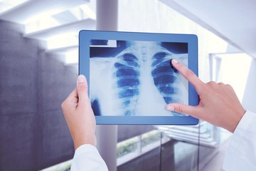 Aufkleber - Composite image of doctor looking at xray on tablet