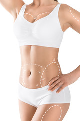 Woman's body marked out for cosmetic surgery. Isolated on white.