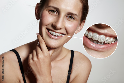 Poster prety girl is smiling with braces and lens showing them bigger