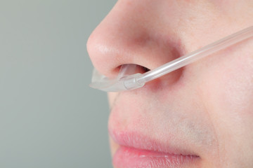 oxygen tube in the patient's nose