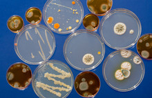 Bacterial Colonies In Petri Dishes