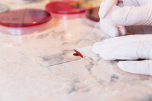 Laboratory Doctor Preparing For A Blood Smear Test Or Blood Film. Two Slides And A Drop Of Blood And Petri Dishes In The Background