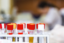 Blood Samples In Test Tube Rack