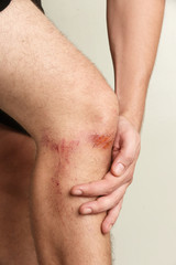 Wall Mural - close up view of nasty wounds on man's knee