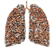 Cigarette butts in pulmonary contour
