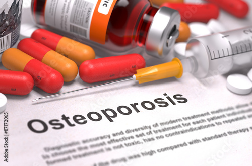 Fotografía Osteoporosis Diagnosis. Medical Concept.