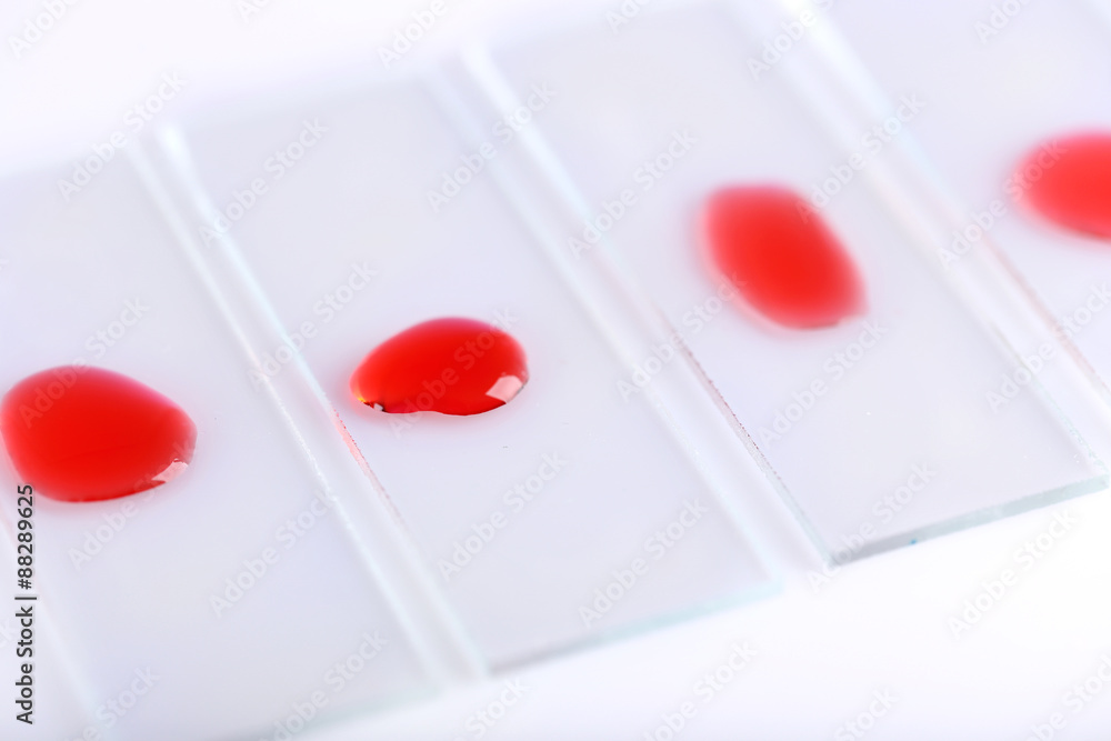 Laboratory analysis of blood close up