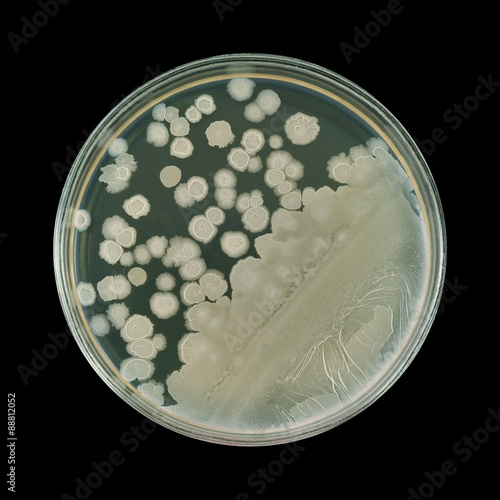 Bacterial colonies on petri dish plate isolated on a black background