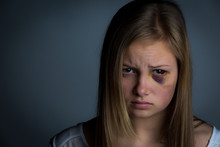 Sad And Intimidated Girl With Heavy Bruising