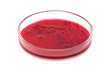 Red colonies of bacteria (Escherichia coli)  on a petri plate (dish) isolated on white background. Agar Endo nutrient media used.  Focus on full depth.
