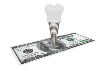 Poster - Cost of dental concept. Tooth Implant With Money