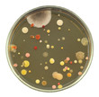 Different color, size and type colonies of bacteria from public hall air on a petri dish (agar plate) isolated on black background. 