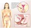Pilzinfektion im Vaginalbereich