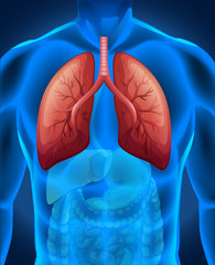 Wall Mural - Lung cancer in human