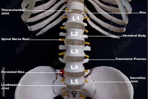 Fotografía Columna lumbar, Vista anterior, Etiquetado