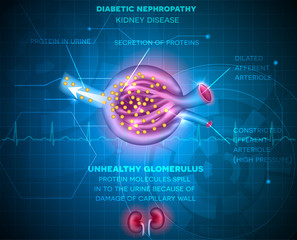 Sticker - Diabetic Nephropathy, kidney disease