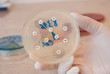 Scientist holding petri dish infected with Escherichia Colli bacteria