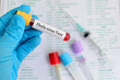 Blood for ebola virus test