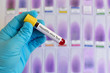 Blood for hepatitis virus testing