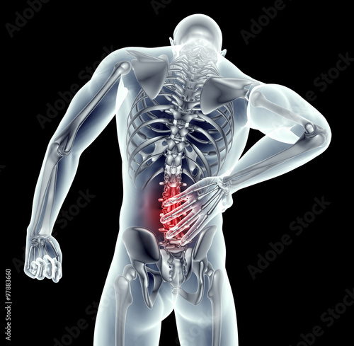 Fotografía x-ray image man with back pain with clipping path